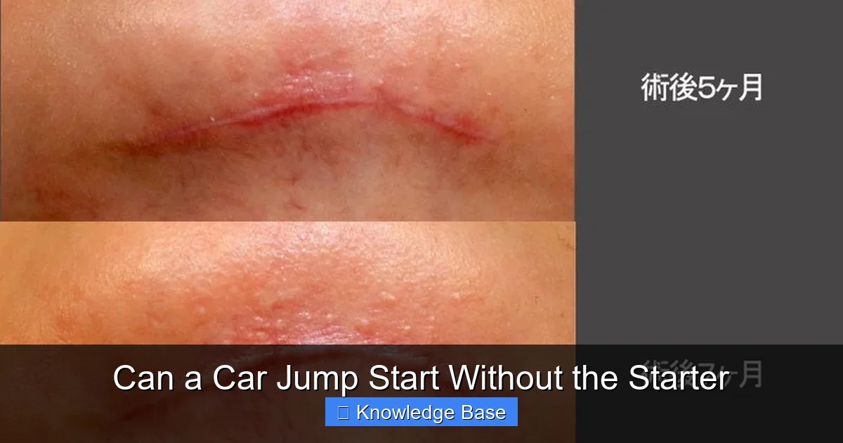 Can a Car Jump Start Without the Starter
